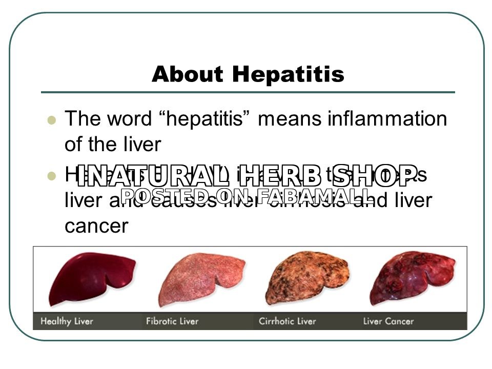 Liver Health Supplements | Shop Now — 3