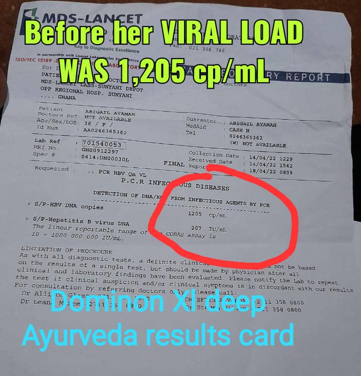 CURE HEPATITIS B OR C PERMANENTLY IN GHANA image