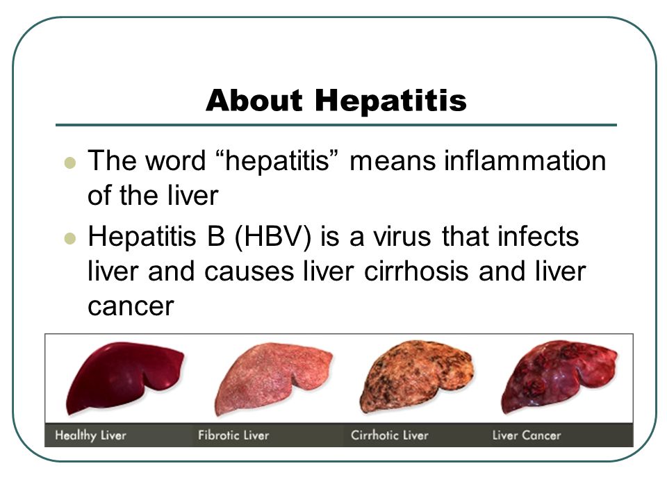 Liver Health Supplements | Shop Now image