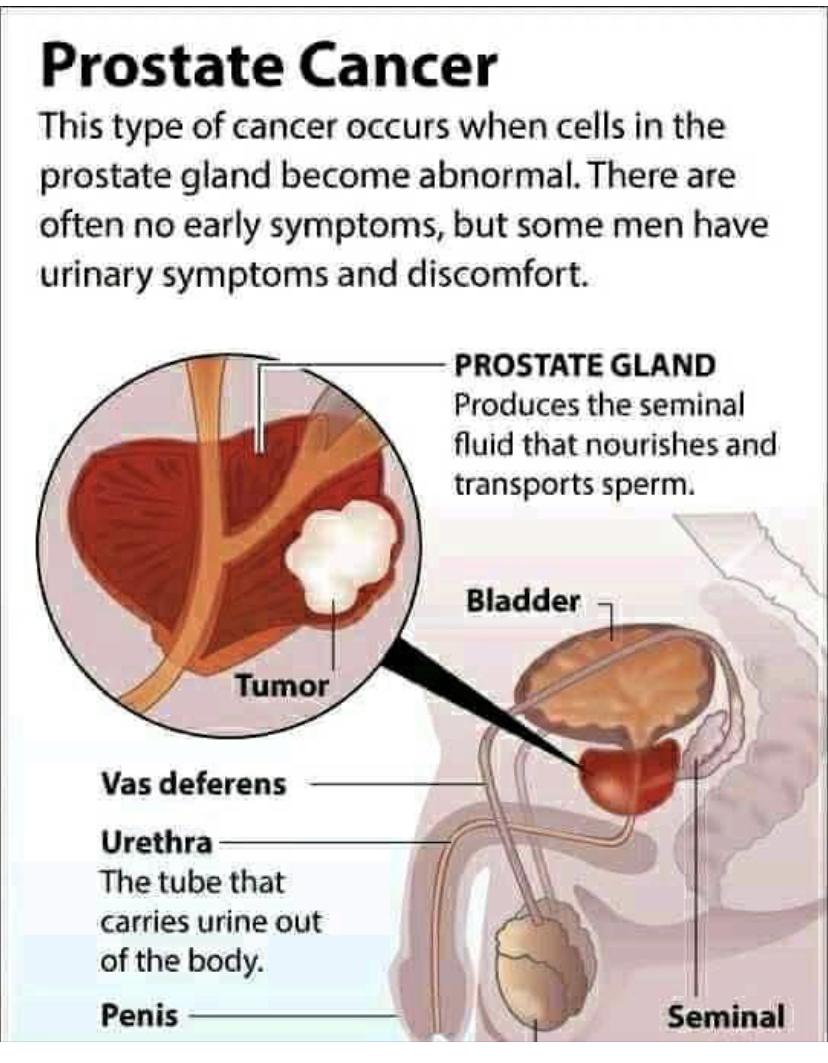 BF Suma Prostate Health Pack In Ghana image