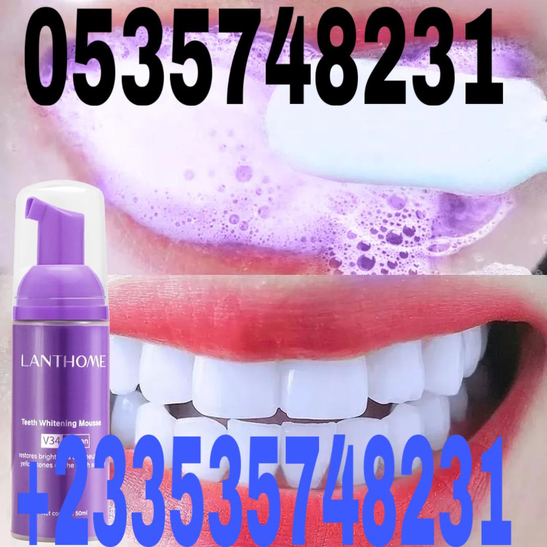 Teeth whitening in 15 minutes image