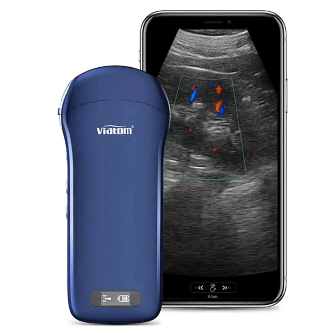 3in1 Handheld Ultrasound Device