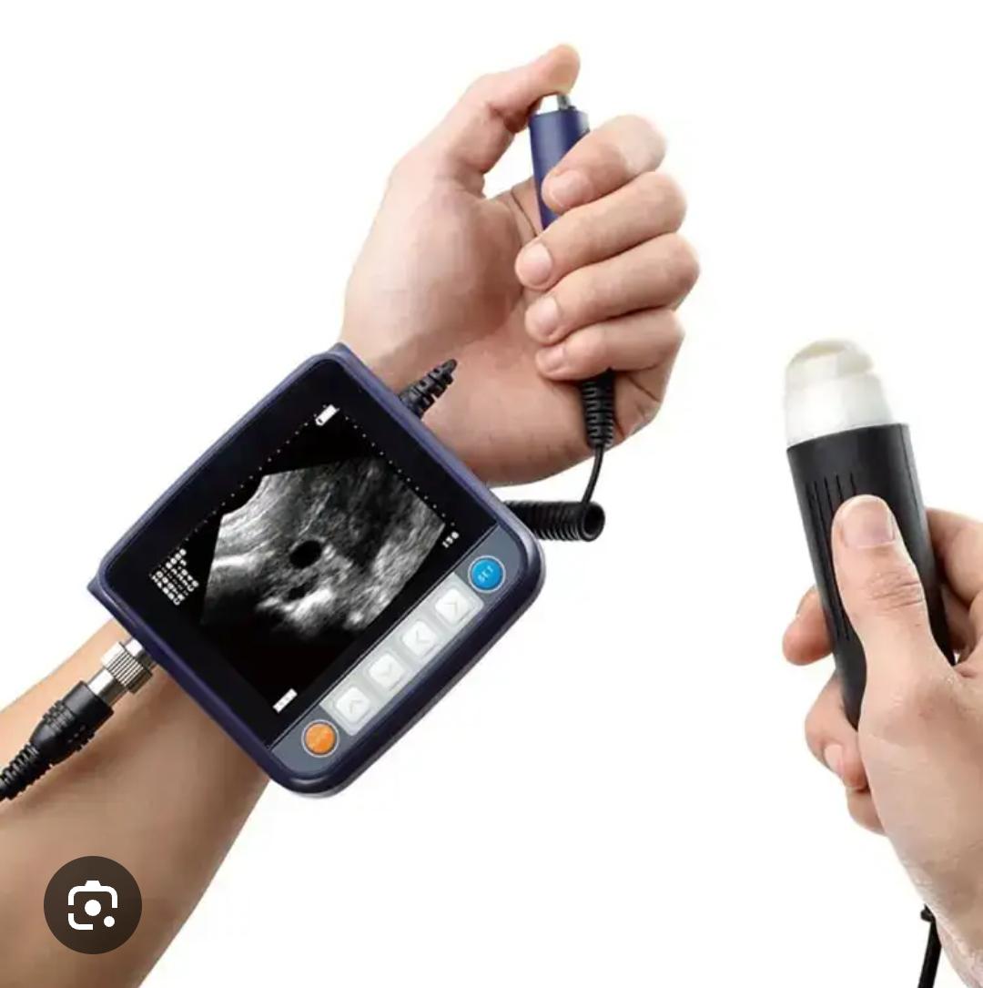 3in1 Handheld Ultrasound Device image