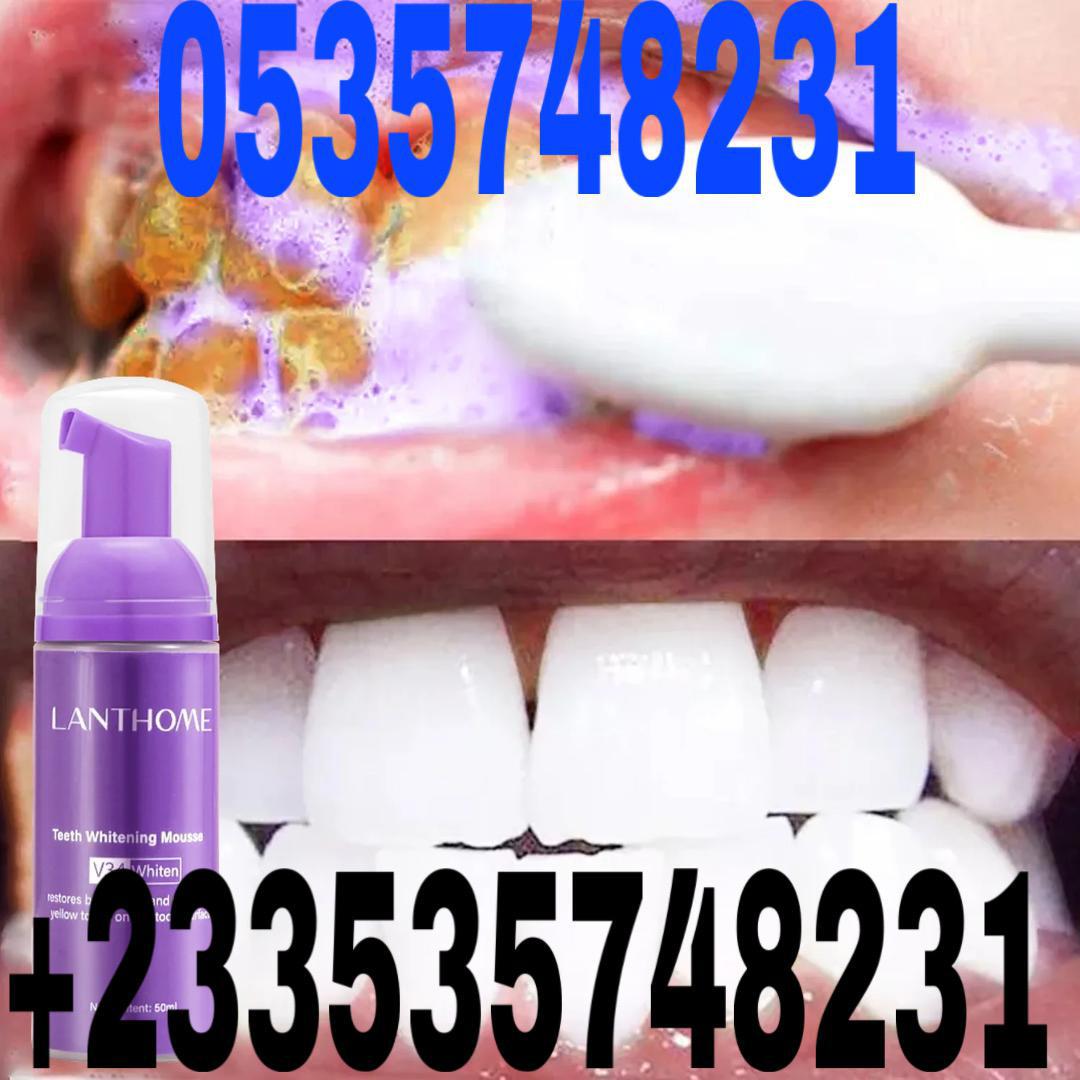 Teeth whitening in 15 minutes