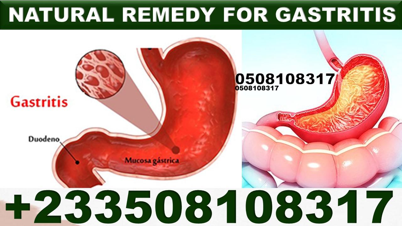 Natural Remedy for stomach ulcer image
