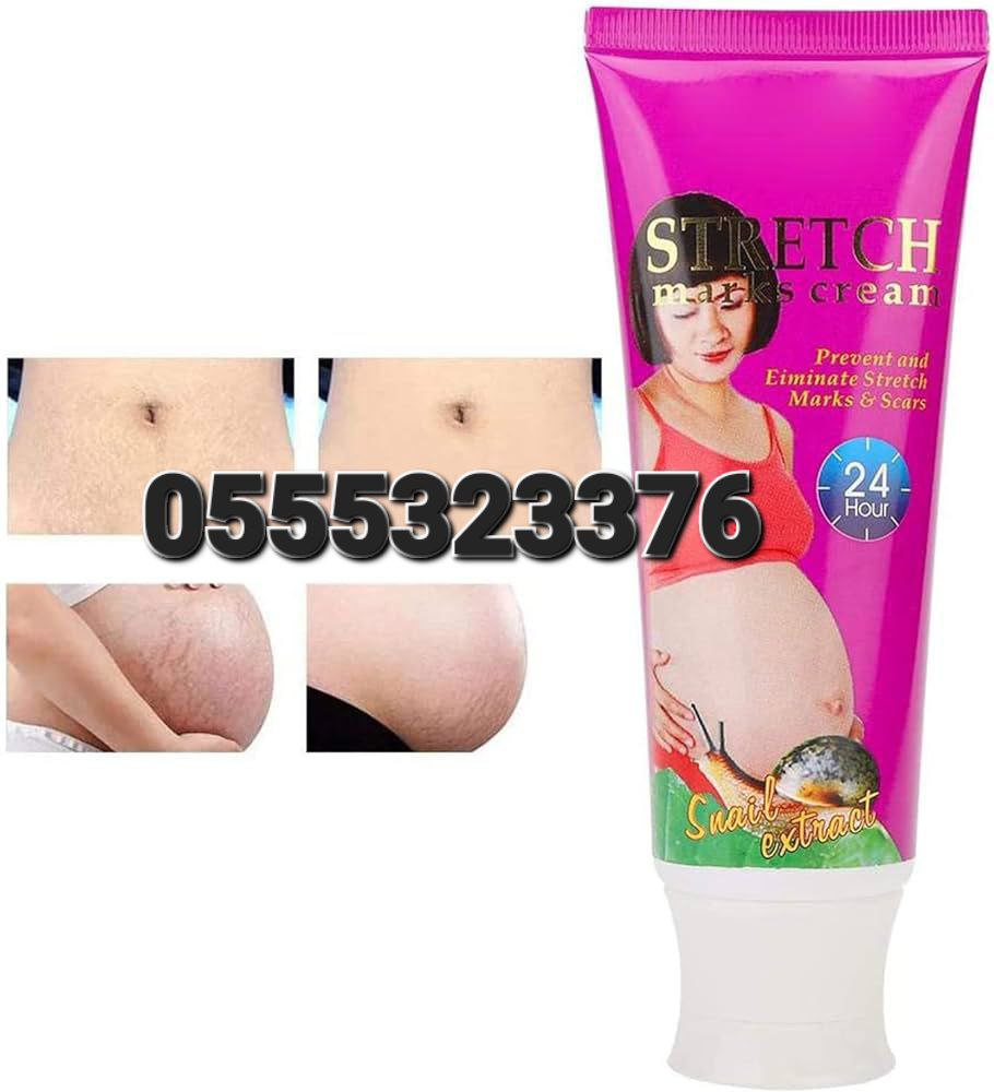 Aichun Beauty Stretch Marks Cream image