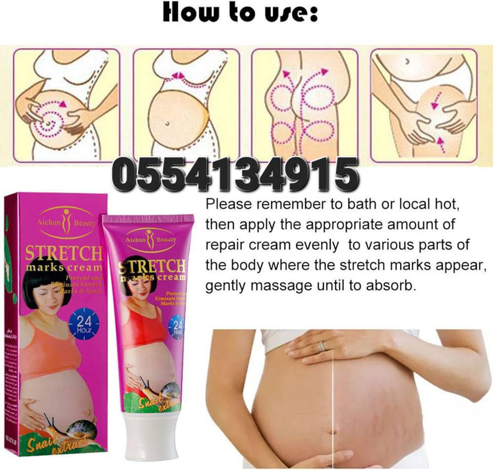 Aichun Beauty Stretch Marks Cream image