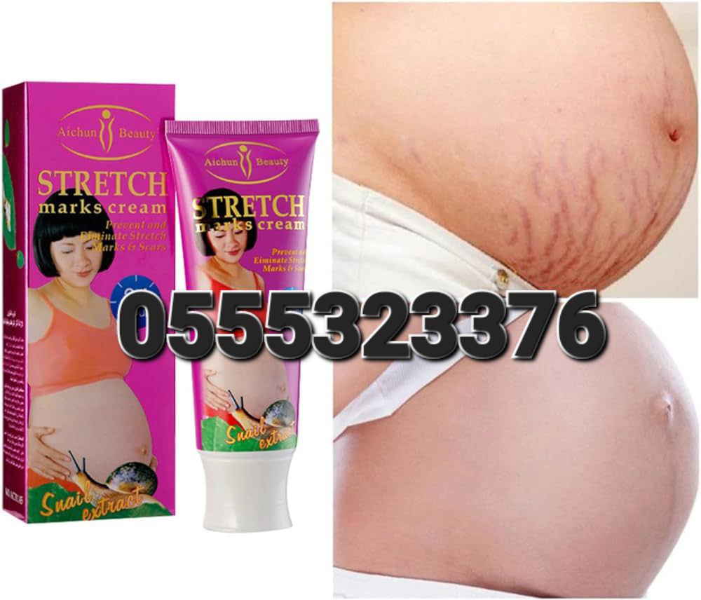 Aichun Beauty Stretch Marks Cream image