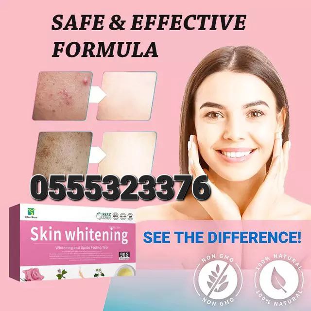 Skin Whitening Supplements Snow Whitening King Of Whitening Gluta Skin Whitening Ghana image