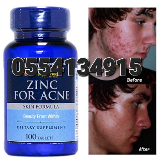 Zinc For Pimples Acne Foam  Removal Creaam And Tablet Ghana image