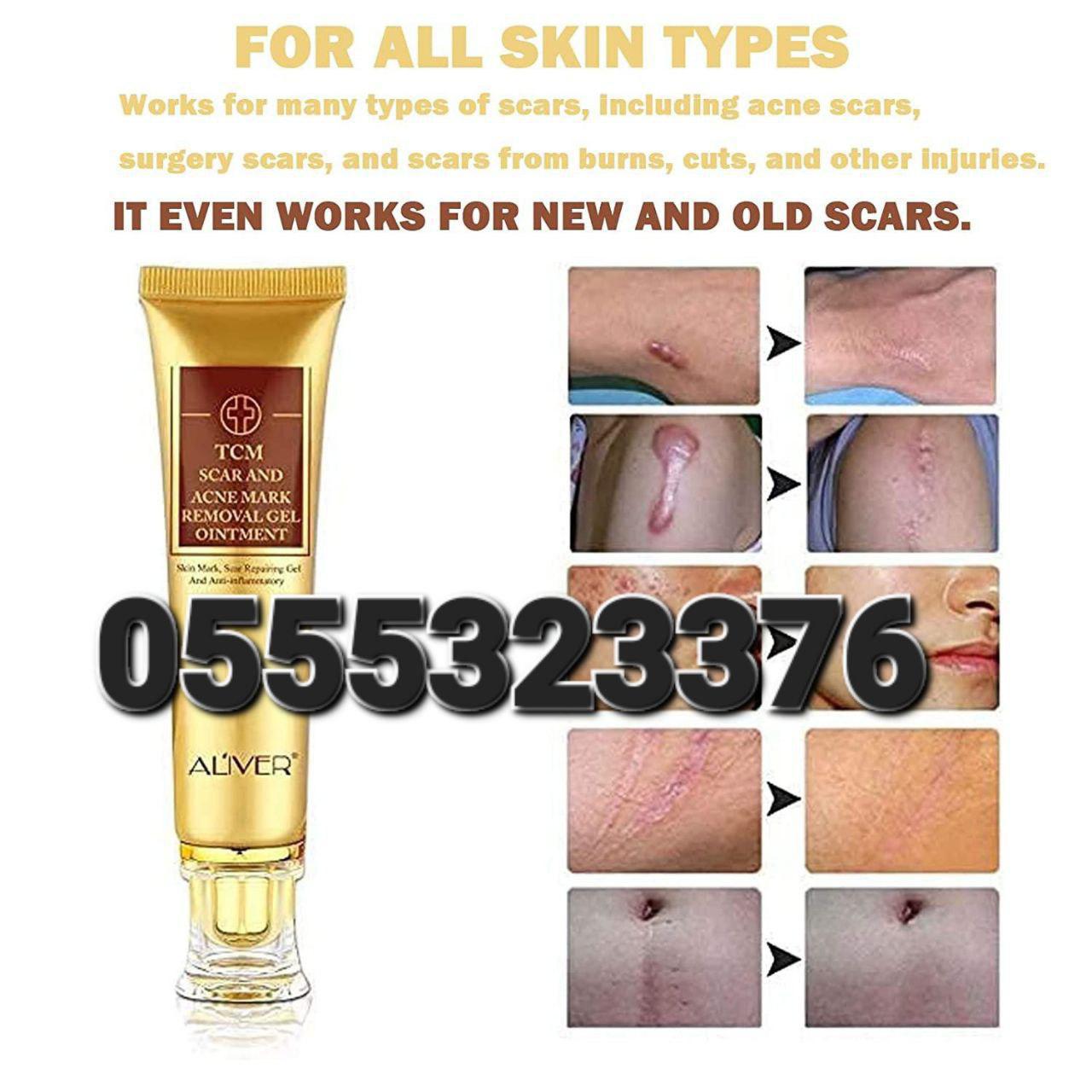 Zinc For Pimples Acne Foam  Removal Creaam And Tablet Ghana image
