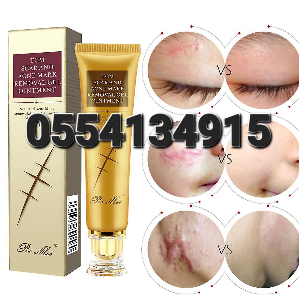 Zinc For Pimples Acne Foam  Removal Creaam And Tablet Ghana image