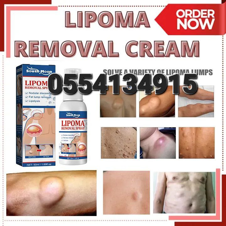 Lipoma Cream And Spray (Reduce Inflammation Subcutaneous Lumps Fat) image