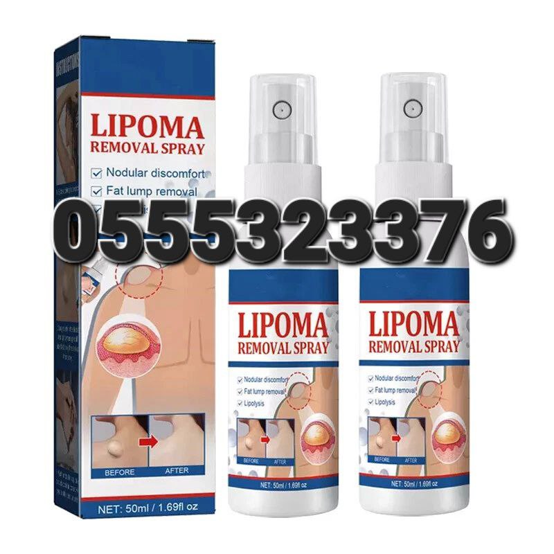 Lipoma Cream And Spray (Reduce Inflammation Subcutaneous Lumps Fat) image